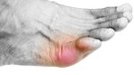 Researchers confirm the feet can reveal these 10 medical conditions