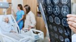 Every second counts: The signs of stroke you need to know