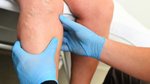 5 Warning Signs of a Blood Clot You Should Never Ignore After 60