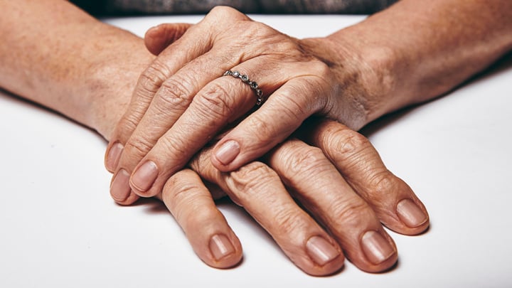 Easy Ways To Get Rid Of Age Spots On Your Hands And Face Starts At 60 Easy Ways To Get Rid Of Age Spots On Your Hands And Face Starts At 60