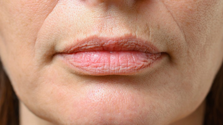 one-amazing-cure-for-cracked-lips-starts-at-60