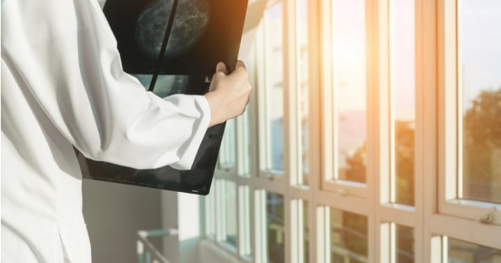 The new reality of breast screens: fast, free, friendly and female