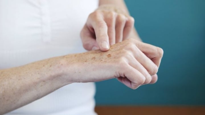 Laser Treatment For Age Spots The Pros And Cons Of A Skin Refresh Starts At 60 Laser Treatment For Age Spots The Pros And Cons Of A Skin Refresh Starts At 60