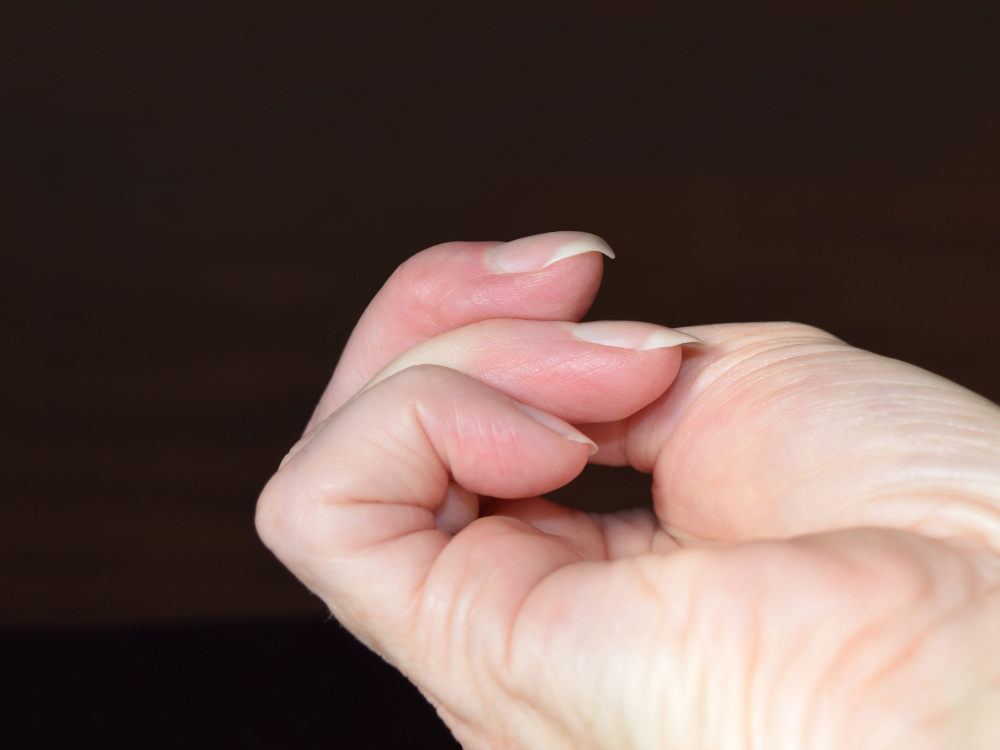 fingernails-could-save-your-life-the-simple-test-that-could-help