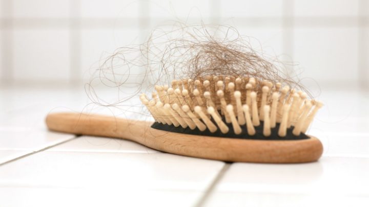Thinning Hair This Could Be The Reason You re Going Bald Starts At 60 thinning-hair-this-could-be-the-reason-you-re-going-bald-starts-at-60