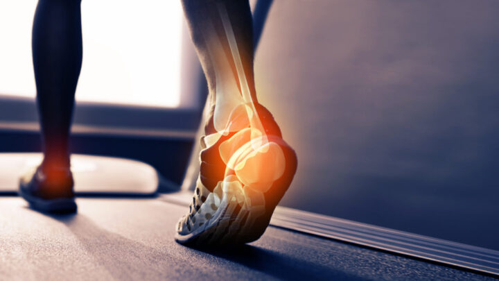 Inflammation is the root cause of many common health problems. Source: Getty