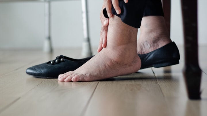 How to reduce fluid retention. Source: Getty
