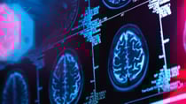 Scientists have discovered that consuming more magnesium-rich foods in our daily diet could lead to better brain health as we age. Source: Getty Images. 